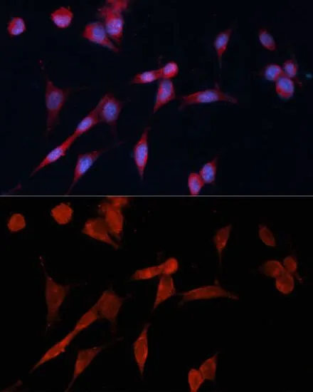 ICC/IF analysis of NIH/3T3 cells using GTX64427 DDAH1 antibody. Blue : DAPI Dilution : 1:100
