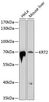 WB analysis of various sample lysates using GTX64434 Cytokeratin 2 antibody. Dilution : 1:1000 Loading : 25microg per lane WB analysis of various sample lysates using GTX64434 Cytokeratin 2 antibody. Dilution : 1:1000 Loading : 25microg per lane
