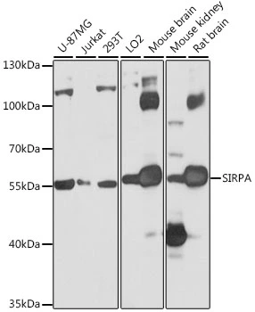WB analysis of various sample lysates using GTX64435 SIRP alpha antibody. Dilution : 1:1000 Loading : 25microg per lane WB analysis of various sample lysates using GTX64435 SIRP alpha antibody. Dilution : 1:1000 Loading : 25microg per lane