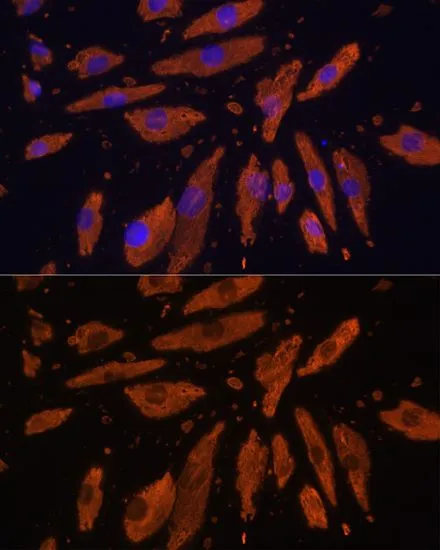 ICC/IF analysis of H9C2 cells using GTX64435 SIRP alpha antibody. Blue : DAPI Dilution : 1:100