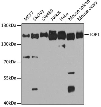 WB analysis of various sample lysates using GTX64445 Topoisomerase I antibody. Dilution : 1:1000 Loading : 25microg per lane
