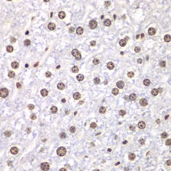 IHC-P analysis of mouse liver tissue using GTX64445 Topoisomerase I antibody. Dilution : 1:100