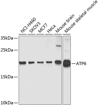 WB analysis of various sample lysates using GTX64448 ATP6 antibody. The signal was developed with ECL plus-Enhanced. Dilution : 1:1000 Loading : 25microg per lane WB analysis of various sample lysates using GTX64448 ATP6 antibody. The signal was developed with ECL plus-Enhanced. Dilution : 1:1000 Loading : 25microg per lane