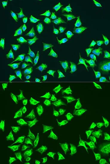 ICC/IF analysis of U2OS cells using GTX64448 ATP6 antibody. Blue : DAPI Dilution : 1:100