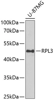 WB analysis of U-87MG cell lysate using GTX64450 RPL3 antibody. Dilution : 1:1000 Loading : 25microg per lane WB analysis of U-87MG cell lysate using GTX64450 RPL3 antibody. Dilution : 1:1000 Loading : 25microg per lane