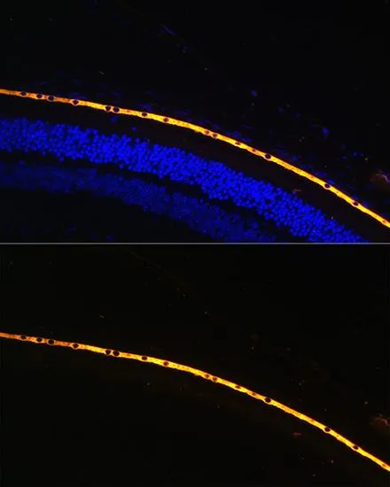 IHC-P analysis of mouse eye tissue using GTX64456 RPE65 antibody. Blue : DAPI Dilution : 1:100