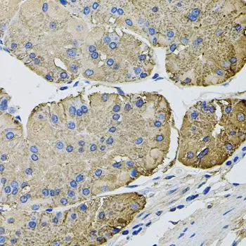 IHC-P analysis of human stomach tissue using GTX64459 Thrombospondin 2 antibody. Dilution : 1:100