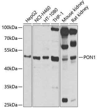 WB analysis of various sample lysates using GTX64465 PON1 antibody. Dilution : 1:1000 Loading : 25microg per lane WB analysis of various sample lysates using GTX64465 PON1 antibody. Dilution : 1:1000 Loading : 25microg per lane