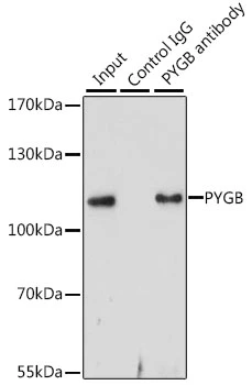 IP analysis of HepG2 cell lysate using GTX64469 GPBB antibody. Antibody amount : 3microg / 200microg lysate Dilution : 1:1000 IP analysis of HepG2 cell lysate using GTX64469 GPBB antibody. Antibody amount : 3microg / 200microg lysate Dilution : 1:1000