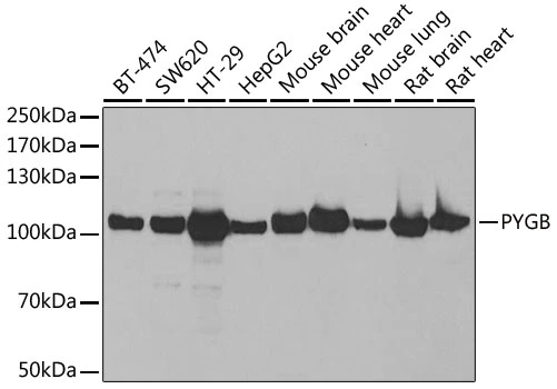WB analysis of various sample lysates using GTX64469 GPBB antibody. Dilution : 1:1000 Loading : 25microg per lane