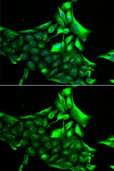 ICC/IF analysis of MCF7 cells using GTX64469 GPBB antibody. Blue : DAPI