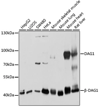 WB analysis of various sample lysates using GTX64471 DAG1 antibody. Dilution : 1:1000 Loading : 25microg per lane WB analysis of various sample lysates using GTX64471 DAG1 antibody. Dilution : 1:1000 Loading : 25microg per lane
