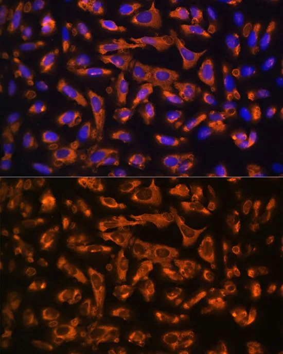 ICC/IF analysis of U2OS cells using GTX64471 DAG1 antibody. Blue : DAPI Dilution : 1:100
