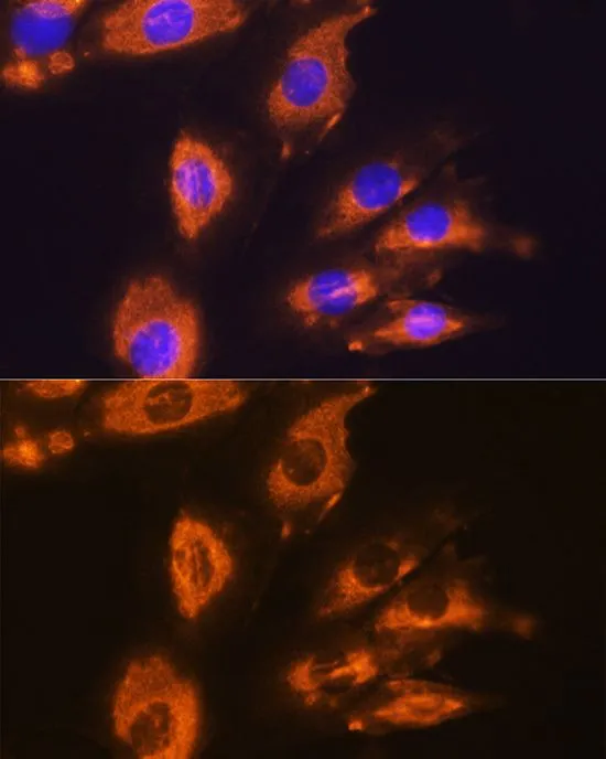 ICC/IF analysis of H9C2 cells using GTX64471 DAG1 antibody. Blue : DAPI Dilution : 1:100