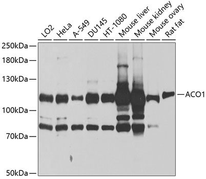 IHC-P analysis of rat kidney tissue using GTX64472 Aconitase 1 antibody. Dilution : 1:100