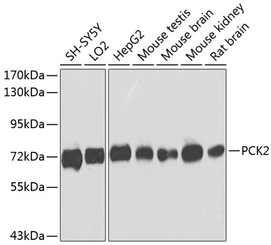 WB analysis of various sample lysates using GTX64476 PCK2 antibody. The signal was developed with ECL plus-Enhanced. Dilution : 1:1000 Loading : 25microg per lane