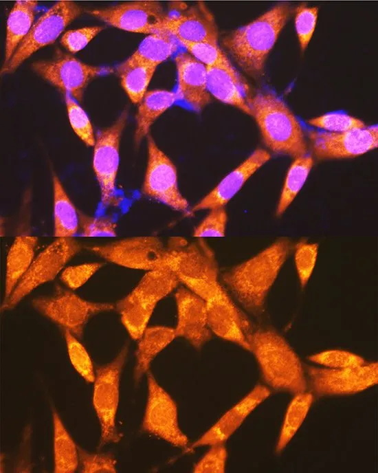 ICC/IF analysis of NIH/3T3 cells using GTX64476 PCK2 antibody. Blue : DAPI Dilution : 1:100