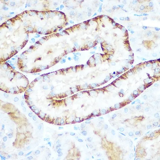 IHC-P analysis of mouse kidney tissue using GTX64476 PCK2 antibody. Dilution : 1:100