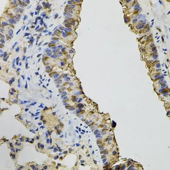 IHC-P analysis of mouse lung tissue using GTX64478 Dynamin 2 antibody.