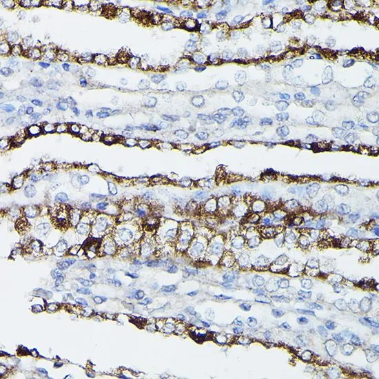 IHC-P analysis of rat kidney tissue using GTX64481 Aquaporin 3 antibody. Dilution : 1:50