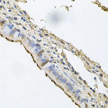 IHC-P analysis of human trachea tissue using GTX64482 Desmoglein 1 antibody. Dilution : 1:100