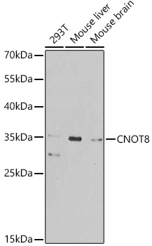 WB analysis of various sample lysates using GTX64486 CNOT8 antibody. Dilution : 1:1000 Loading : 25microg per lane WB analysis of various sample lysates using GTX64486 CNOT8 antibody. Dilution : 1:1000 Loading : 25microg per lane