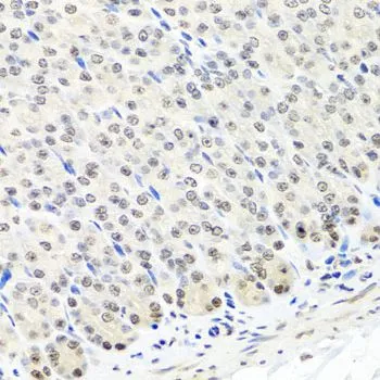 IHC-P analysis of mouse stomach tissue using GTX64486 CNOT8 antibody. Dilution : 1:100