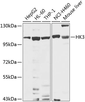 WB analysis of various sample lysates using GTX64487 Hexokinase III antibody. Dilution : 1:1000 Loading : 25microg per lane WB analysis of various sample lysates using GTX64487 Hexokinase III antibody. Dilution : 1:1000 Loading : 25microg per lane