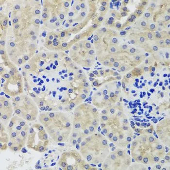 IHC-P analysis of mouse kidney tissue using GTX64487 Hexokinase III antibody. Dilution : 1:100