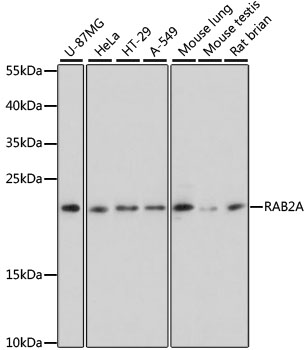 WB analysis of various samples using GTX64489 RAB2A antibody. Dilution : 1:3000 Loading : 25ug per lane