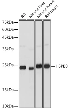 WB analysis of various sample lysates using GTX64490 HSP22 antibody. Dilution : 1:3000 Loading : 25microg per lane WB analysis of various sample lysates using GTX64490 HSP22 antibody. Dilution : 1:3000 Loading : 25microg per lane