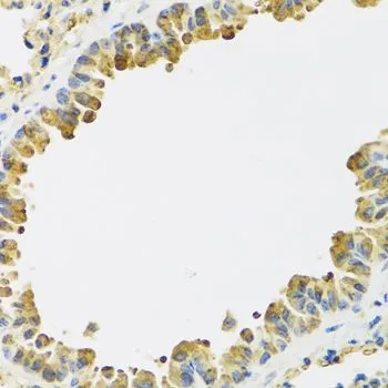 IHC-P analysis of mouse lung tissue using GTX64492 HRG antibody. Dilution : 1:100