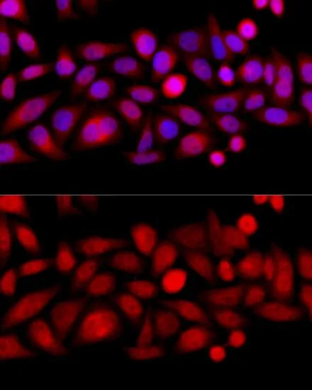 ICC/IF analysis of HeLa cells using GTX64498 KIF4A antibody. Blue : DAPI Dilution : 1:100