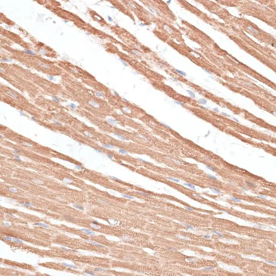 IHC-P analysis of rat heart tissue using GTX64498 KIF4A antibody. Dilution : 1:100