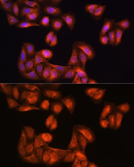 ICC/IF analysis of U2OS cells using GTX64499 PHGDH antibody. Blue : DAPI Dilution : 1:100
