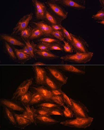 ICC/IF analysis of H9C2 cells using GTX64499 PHGDH antibody. Blue : DAPI Dilution : 1:100