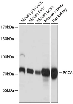 WB analysis of various sample lysates using GTX64505 PCCA antibody. Dilution : 1:3000 Loading : 25microg per lane