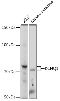 WB analysis of various sample lysates using GTX64507 KCNQ1 antibody. The signal was developed with ECL plus-Enhanced. Dilution : 1:1000 Loading : 25microg per lane