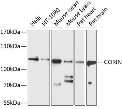 WB analysis of various sample lysates using GTX64508 CORIN antibody. Dilution : 1:1000 Loading : 25microg per lane WB analysis of various sample lysates using GTX64508 CORIN antibody. Dilution : 1:1000 Loading : 25microg per lane
