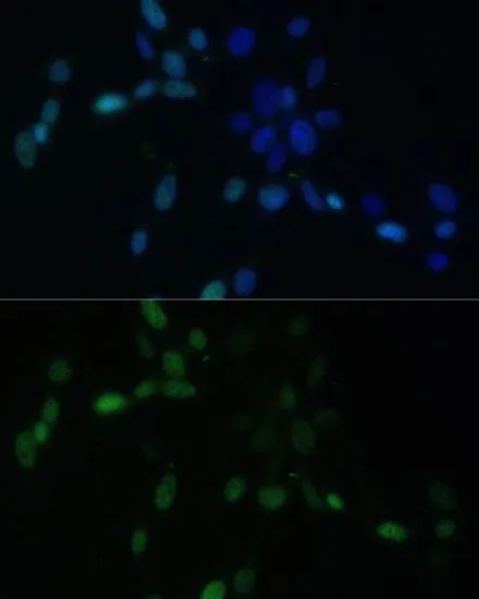 ICC/IF analysis of NIH/3T3 cells using GTX64515 SMAD9 antibody. Blue : DAPI Dilution : 1:100 ICC/IF analysis of NIH/3T3 cells using GTX64515 SMAD9 antibody. Blue : DAPI Dilution : 1:100