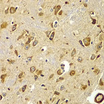 IHC-P analysis of mouse brain tissue using GTX64515 SMAD9 antibody. Dilution : 1:100