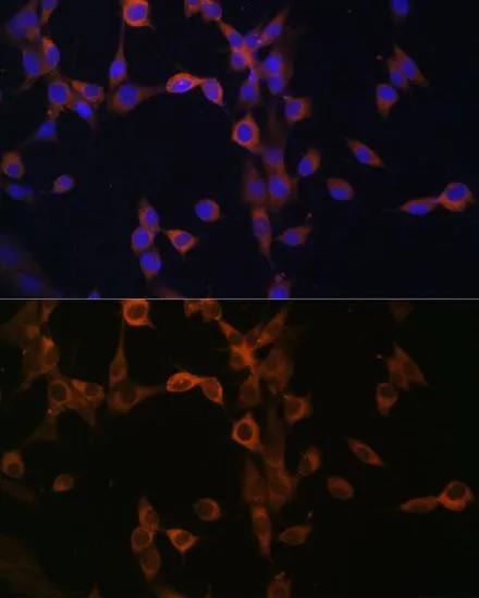 ICC/IF analysis of NIH/3T3 cells using GTX64517 Calcineurin B antibody. Blue : DAPI Dilution : 1:100