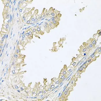IHC-P analysis of human prostate tissue using GTX64517 Calcineurin B antibody. Dilution : 1:100