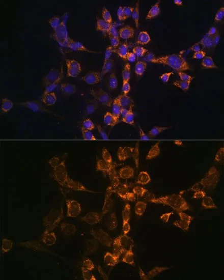 ICC/IF analysis of NIH/3T3 cells using GTX64518 ARTS antibody. Blue : DAPI Dilution : 1:100