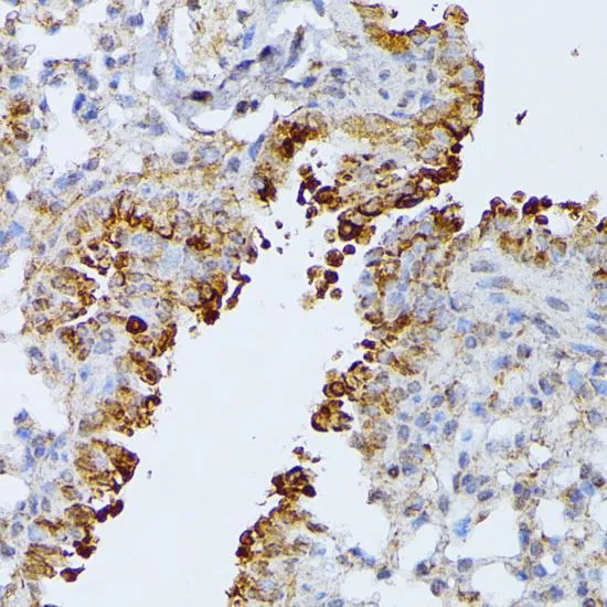 IHC-P analysis of mouse lung tissue using GTX64518 ARTS antibody. Dilution : 1:100