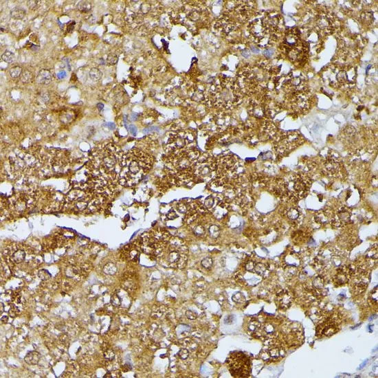 IHC-P analysis of rat liver tissue using GTX64518 ARTS antibody. Dilution : 1:100