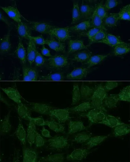 ICC/IF analysis of C6 cells using GTX64519 MTHFD2 antibody. Blue : DAPI Dilution : 1:100