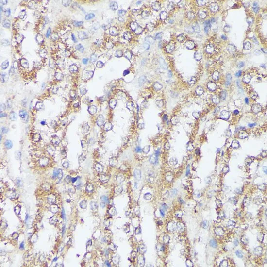 IHC-P analysis of rat kidney tissue using GTX64519 MTHFD2 antibody. Dilution : 1:100