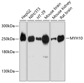 WB analysis of various sample lysates using GTX64520 MYH10 antibody. Dilution : 1:3000 Loading : 25microg per lane WB analysis of various sample lysates using GTX64520 MYH10 antibody. Dilution : 1:3000 Loading : 25microg per lane