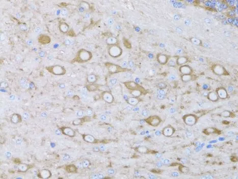 IHC-P analysis of mouse brain tissue using GTX64520 MYH10 antibody. Dilution : 1:100